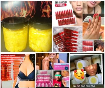 Savon molato super dosé pas besoin de ce pommadé ça enleve les quinto vergetures tâches bouton ça unifie le temps de la tête au pied à un prix abordable prends tes ampoule buvable et le savon molato oublie les problèmes de la peau